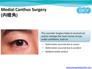 Medial Canthus Surgery
(۽)
This cosmetic Surgery helps to reconstruct
and/or reshape the inner corner of eye,
under conditions, such as:
? Deformation occurred due to cancer
? Deformation occurred due to accident
? Webbed medial canthus
www.shanghaiskyclinic.com
 