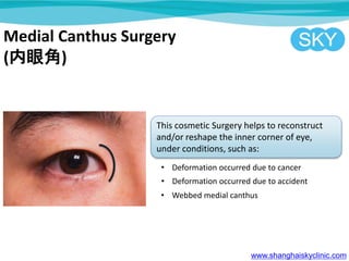 Medial Canthus Surgery
(۽)
This cosmetic Surgery helps to reconstruct
and/or reshape the inner corner of eye,
under conditions, such as:
? Deformation occurred due to cancer
? Deformation occurred due to accident
? Webbed medial canthus
www.shanghaiskyclinic.com
 