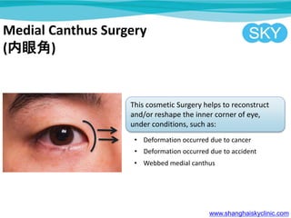 Medial Canthus Surgery
(۽)
This cosmetic Surgery helps to reconstruct
and/or reshape the inner corner of eye,
under conditions, such as:
? Deformation occurred due to cancer
? Deformation occurred due to accident
? Webbed medial canthus
www.shanghaiskyclinic.com
 