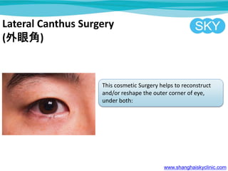 Lateral Canthus Surgery
(۽)
This cosmetic Surgery helps to reconstruct
and/or reshape the outer corner of eye,
under both:
www.shanghaiskyclinic.com
 