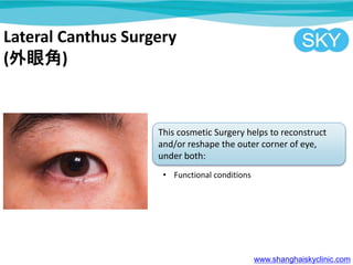 Lateral Canthus Surgery
(۽)
This cosmetic Surgery helps to reconstruct
and/or reshape the outer corner of eye,
under both:
? Functional conditions
www.shanghaiskyclinic.com
 
