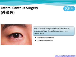 Lateral Canthus Surgery
(۽)
This cosmetic Surgery helps to reconstruct
and/or reshape the outer corner of eye,
under both:
? Functional conditions
? Aesthetic conditions
www.shanghaiskyclinic.com
 