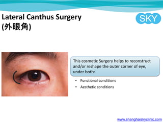 Lateral Canthus Surgery
(۽)
This cosmetic Surgery helps to reconstruct
and/or reshape the outer corner of eye,
under both:
? Functional conditions
? Aesthetic conditions
www.shanghaiskyclinic.com
 