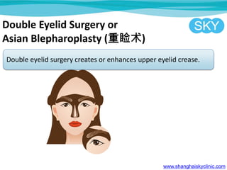 Double Eyelid Surgery or
Asian Blepharoplasty ()
Double eyelid surgery creates or enhances upper eyelid crease.
www.shanghaiskyclinic.com
 