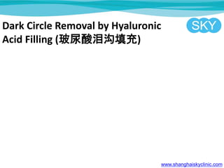 Dark Circle Removal by Hyaluronic
Acid Filling (ṵ)
www.shanghaiskyclinic.com
 