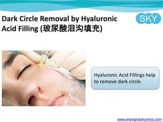 Dark Circle Removal by Hyaluronic
Acid Filling (ṵ)
Hyaluronic Acid Fillings help
to remove dark circle.
www.shanghaiskyclinic.com
 