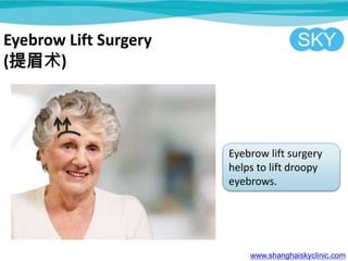 Eyebrow Lift Surgery
(ü)
Eyebrow lift surgery
helps to lift droopy
eyebrows.
www.shanghaiskyclinic.com
 