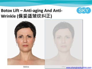 Botox Lift C Anti-aging And Anti-
Wrinkle (ƾ)
www.shanghaiskyclinic.com
 