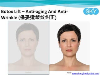 Botox Lift C Anti-aging And Anti-
Wrinkle (ƾ)
www.shanghaiskyclinic.com
 