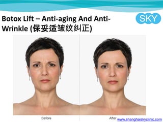 Botox Lift C Anti-aging And Anti-
Wrinkle (ƾ)
www.shanghaiskyclinic.com
 