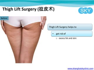 Thigh Lift Surgery (拉皮术)
www.shanghaiskyclinic.com
Before
Thigh Lift Surgery helps to
• get rid of
o excess fat and skin
 
