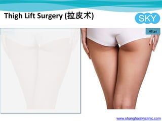 Thigh Lift Surgery (拉皮术)
www.shanghaiskyclinic.com
Before After
 