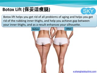 www.shanghaiskyclinic.com
Botox lift helps you get rid of all problems of aging and helps you get
rid of the rubbing inner thighs, and help you achieve gap between
your inner thighs, and as a result enhances your silhouette.
Botox Lift (保妥适瘦腿)
Before After
 