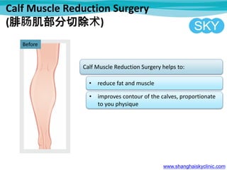 Calf Muscle Reduction Surgery
(腓肠肌部分切除术)
www.shanghaiskyclinic.com
Before
Calf Muscle Reduction Surgery helps to:
• reduce fat and muscle
• improves contour of the calves, proportionate
to you physique
 