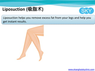 www.shanghaiskyclinic.com
Liposuction helps you remove excess fat from your legs and help you
get instant results.
Liposuction (吸脂术)
 