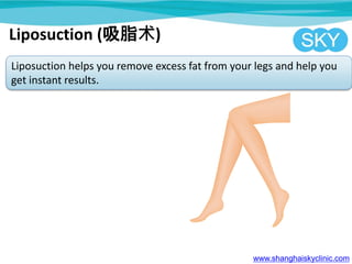 www.shanghaiskyclinic.com
Liposuction helps you remove excess fat from your legs and help you
get instant results.
Liposuction (吸脂术)
 