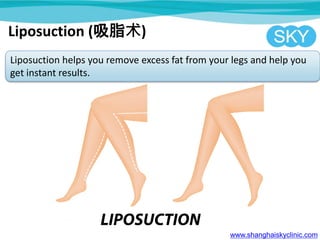 www.shanghaiskyclinic.com
Liposuction helps you remove excess fat from your legs and help you
get instant results.
Liposuction (吸脂术)
 