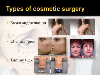 

Breast augmentation



Chemical peel



Tummy tuck

 