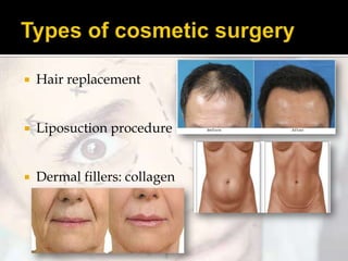 

Hair replacement



Liposuction procedure



Dermal fillers: collagen

 
