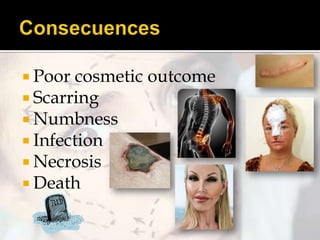  Poor cosmetic
 Scarring
 Numbness
 Infection
 Necrosis
 Death

outcome

 