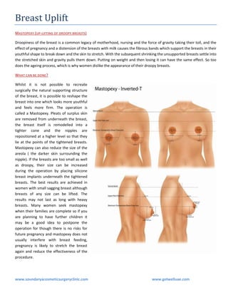 Breast Uplift
MASTOPEXY (UP-LIFTING OF DROOPY BREASTS)
Droopiness of the breast is a common legacy of motherhood, nursing and the force of gravity taking their toll, and the
effect of pregnancy and a distension of the breasts with milk causes the fibrous bands which support the breasts in their
youthful shape to break down and the skin to stretch. With the subsequent shrinking the unsupported breasts settle into
the stretched skin and gravity pulls them down. Putting on weight and then losing it can have the same effect. So too
does the ageing process, which is why women dislike the appearance of their droopy breasts.
WHAT CAN BE DONE ?
Whilst it is not possible to recreate
surgically the natural supporting structure
of the breast, it is possible to reshape the
breast into one which looks more youthful
and feels more firm. The operation is
called a Mastopexy. Pleats of surplus skin
are removed from underneath the breast,
the breast itself is remodelled into a
tighter cone and the nipples are
repositioned at a higher level so that they
lie at the points of the tightened breasts.
Mastopexy can also reduce the size of the
areola ( the darker skin surrounding the
nipple). If the breasts are too small as well
as droopy, their size can be increased
during the operation by placing silicone
breast implants underneath the tightened
breasts. The best results are achieved in
women with small sagging breast although
breasts of any size can be lifted. The
results may not last as long with heavy
breasts. Many women seek mastopexy
when their families are complete so if you
are planning to have further children it
may be a good idea to postpone the
operation for though there is no risks for
future pregnancy and mastopexy does not
usually interfere with breast feeding,
pregnancy is likely to stretch the breast
again and reduce the effectiveness of the
procedure.

www.soundaryacosmeticsurgeryclinic.com

www.getwelluae.com

 