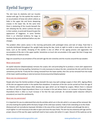 Eyelid Surgery
The skin loses its elasticity and our muscles
slacken with age. For the eyelids this results in
an accumulation of loose skin which collects as
folds in the upper lids and forms deepening
creases in the lower lids. At the same time
there is slackening of the muscle beneath the
skin allowing the fat, which cushions the eyes
in their sockets, to protrude forward to give the
appearance of bagginess. In some families
there is an inherited tendency for bags to
develop during early adulthood before any skin
changes.
The problem often seems worse in the morning particularly with prolonged stress and lack of sleep. Fluid that is
normally distributed throughout the upright body during the day, tends at night to settle in areas where the skin is
loose, such as the eyelids. Drooping of the eyelids is also an effect of the ageing process and aggravates the
accumulation of the skin in the upper eyelids. Sometimes so much skin accumulates in the upper lids that it hangs over
the eyelashes to obstruct vision.
Bags are caused by an accumulation of fat and with age the skin stretches and the muscles around the eye weaken.
WHAT CAN BE DONE ?
An eyelid reduction (blepharoplasty) removes the surplus skin and protruding fat to produce a more alert appearance
and reduces the morning swelling. Sometimes it is only necessary to reduce the skin, sometimes the skin and the fat and
sometimes just the fat. If only the fat is being removed from the lower eyelids, then this can be removed from the inside
of the lower eyelid avoiding an external excision (transconjunctival blepharoplasty)
WHAT ARE THE CONSEQUENCES?
People who have the familial problem of bags beneath the eyes may well undergo surgery in their 20?s. Ageing effects
of the skin are apparent earlier in the eyelids than elsewhere. A reduction of the skin can be carried out from the age of
35. Patients with thyroid disease often develop eye signs which can be helped by surgery. Where there is reduced
secretion of thyroxin (hypo-thyroidism) there is an increase in fat and where there is an increase in thyroxine (hyperthyroidism) there is often so much increase in fat that the eyes protrude. An extended eyelid reduction (Olivari?s
procedure) can treat this satisfactorily.
WHAT ARE THE LIMITATIONS?
It is important for you to understand that only the wrinkles which are in the skin which is cut away will be removed. We
are only treating the eyelids within the bony margin of the orbit (eye sockets). Folds of skin extending on to the cheek
(festoons) will not normally be improved. Wrinkles in the area of the crow?s feet will remain and although the skin is
much tighter it is still necessary to be able to open and close the eyes freely. The skin has less elasticity with age and for
proper closure of the eye the upper eyelid will need to have surplus skin when it is open. Descent of the eyebrow can be

www.soundaryacosmeticsurgeryclinic.com

www.getwelluae.com

 