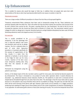 Lip Enhancement
This is suitable for anyone who would like larger or fuller lips. In addition there are people who were born with
abnormalities of the lips or who’s lips have become deformed for one reason or another in later life.
PROCEDURES AVAILABLE
There are a large number of different procedures to choose from but they can be grouped together.
Temporary enhancement Many substances have been used to temporarily enlarge the lips. These substances are
primarily injected under the white line. That is the white hair free line which outlines the vermilion (red mucosa) of the
lip and is distinct from normal lip skin. This gives a pouting (Paris) lip. (see illustration). The bulk of the lip can be
increased by injections into the muscle but these tend to dissolve at a faster rate. The commonest material used is
collagen for which an allergy test is required. Recently hyaluronic acid gel (Hylaform,Restylane) has been used. All these
dissolving substances need to be topped up every 3 to 6 months.
FAT INJECTION
This is usually considered to be
temporary. It has the advantage that
one is using the patient’s own tissue
and therefore there will be no allergic
reaction. The fat is collected either as
part of some other liposuction
procedure or harvested specifically for
the purpose of augmentation of the
lips. Usually it is taken from the
abdomen or buttocks. It can be stored
in the fridge for later use for many
months. Injection of fat does cause
more temporary swelling (bee sting
lips) than the injection of other
substances.
Permanent lip enlargement using the
patient’s own tissue
Dermis, or the deeper layers of the skin, has been used as a graft for many years, but recently has become popular for
lip enhancement. The tissue is harvested as a by product of some other operation where it would otherwise be
discarded – e.g., abdominal reduction, breast reduction, facelift, etc. The epidermis or outer skin is removed and the
shaped dermis threaded through from one side of lip to the other. The advantage is that this tissue takes well as a graft
because it is the patient’s own tissue therefore there will be no problems of allergy. The graft may not take fully and
there will be some thinning of the dermis with age. However, good results can be achieved. It is a bigger procedure,
producing more swelling for longer (one to three weeks) and can also create complications of infection and bleeding, as
in any operation. An alternative graft to dermis is fascia (the covering of muscle). This can be the temporalis fascia from

www.soundaryacosmeticsurgeryclinic.com

www.getwelluae.com

 