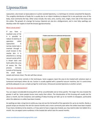 Liposuction
Liposuction, also known as liposculpture or suction assisted lipectomy, is a technique to remove unwanted fat deposits.
The unsightly distribution of body fat is usually due to an inborn tendency to deposit fat in one particular area of the
body, most commonly the hips. Other areas include; the neck, arms, tummy, loins, thighs, inner side of the knees and
the ankles. The growth of a benign fat tumour (lipoma) can also be a disfigurement, and in men fatty swellings can
develop under the nipples to look like breasts (gynaecomastia).
WHAT CAN BE DONE ?
If you have a
localised area of fat
it is possible to
reduce its bulk by an
operation
called
Liposuction.
A
narrow metal tube is
inserted through a
small incision in the
nearby skin. It is
attached to a strong
vacuum pump which
is drawn back and
forth within the area
of excess fat. The
process
removes
tunnels of fat leaving
the small blood
vessels and nerves intact. The skin will then retract.
There are some minor variants in the techniques. Some surgeons inject the area to be treated with solutions (wet or
tumescent technique) others do not. Suction is usually applied with a powerful vacuum machine, but it is some-times
perfectly adequate to use a simple syringe for small areas. Ultrasound assisted lipectomy is another variant.
WHAT ARE THE CONSEQUENCES?
You can expect considerable bruising which will be uncomfortable and at times painful. The larger the area treated the
greater it will be. Some people bruise more easily than others. The discoloration of this bruising will usually last for
about a month, but the lumpiness and swelling of deep bruising can take up to six months to disappear, particularly
when the abdomen or ankles have been treated.
As swelling can take a long time to settle you may not see the full benefit of the operation for up to six months. Rarely, a
greyish stripe can discolour the skin for several months and is more commonly seen when the ankles have been treated.
If you have a tendency to be anaemic, or if you were to have a large area treated, you may need to take iron tablets for a
month. You can expect some numbness in the treated skin which lasts for several months.

www.soundaryacosmeticsurgeryclinic.com

www.getwelluae.com

 