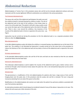 Abdominal Reduction
Abdominoplasty or Tummy Tuck. In this procedure excess skin and fat can be removed, abdominal contours and scars
improved, and the muscles tightened. Different combinations are combined in the various procedures.
THE STANDARD ABDOMINOPLASTY
The excess skin and fat of the abdominal wall between the pubic area and
the umbilicus (navel) is removed leaving the umbilicus in place. The skin of
the abdominal wall at the level of the umbilicus is then drawn down to
suture it to at the pubic level. The patient is left with a long, usually curved
scar across the lower part of the abdominal wall at the level of the pubic
hair. There is also a scar around the umbilicus. Any looseness of the
muscles of the abdominal wall or hernia is repaired at the same time – see
Figure.
Liposuction may be carried out during this procedure to thin the abdominal wall, or as a separate procedure either
before or after the Abdominoplasty.
MINI-ABDOMINOPLASTY
In the Mini-Abdominoplasty surplus skin below the umbilicus is removed leaving a low abdominal scar at the level of the
pubic hair. The umbilicus is not disturbed but liposuction is usually carried out at the same time as the procedure to
reduce the thickness of fat in the abdominal wall and any laxity or hernia of the abdominal wall is repaired at the same
time.
EXTENDED ABDOMINOPLASTY
In the extended abdominoplasty surplus skin and fat of the loins and back are also removed so that the scar extends
around the flanks onto the lower back.
ENDOSCOPIC ABDOMINOPLASTY
The endoscopic abdominoplasty is used to tighten the muscles of the abdominal wall to give a better contour and is
carried out through a short transverse incision above the pubic hair. Skin is not removed but liposuction can be carried
out at the same time.
APRONECTOMY
The apronectomy is a modification of the mini-abdominoplasty for patients who have a large excess of skin and fat
hanging down over the pubic area. In this procedure only the surplus skin and fat is removed. The scar is long and
transverse extending from one side of the apron to the other.
Modifications to the abdominoplasty skin excision are made when the patient has particular problems associated with
scars from previous operations.
An alternative procedure which should always be considered instead of many of the above is liposuction on its own. This
reduces fat and causes just a little retraction of the skin.
www.soundaryacosmeticsurgeryclinic.com

www.getwelluae.com

 