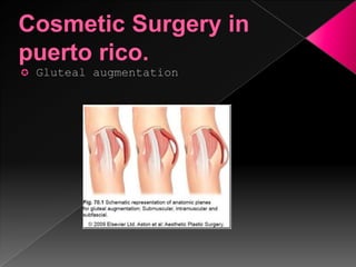 Cosmetic surgery