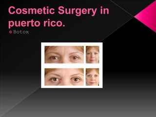Cosmetic surgery
