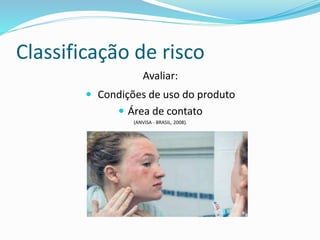 Classificação de risco
Avaliar:
 Condições de uso do produto
 Área de contato
(ANVISA - BRASIL, 2008).
 