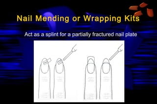 Nail Mending or Wrapping Kits
Act as a splint for a partially fractured nail plate

 