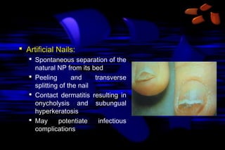  Artificial Nails:
 Spontaneous separation of the
natural NP from its bed
 Peeling
and
transverse
splitting of the nail
 Contact dermatitis resulting in
onycholysis and subungual
hyperkeratosis
 May
potentiate
infectious
complications

 