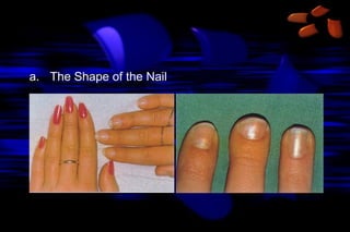 a. The Shape of the Nail

 
