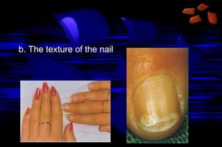 b. The texture of the nail

 