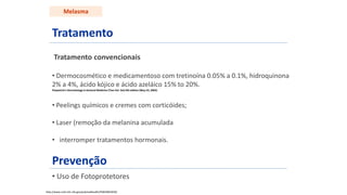 Tratamento
Tratamento convencionais
• Dermocosmético e medicamentoso com tretinoína 0.05% a 0.1%, hidroquinona
2% a 4%, ácido kójico e ácido azeláico 15% to 20%.
Fitzpatrick's Dermatology In General Medicine (Two Vol. Set) 6th edition (May 23, 2003)
• Peelings químicos e cremes com corticóides;
• Laser (remoção da melanina acumulada
• interromper tratamentos hormonais.
Prevenção
• Uso de Fotoprotetores
Melasma
http://www.ncbi.nlm.nih.gov/pubmedhealth/PMH0001839/
 