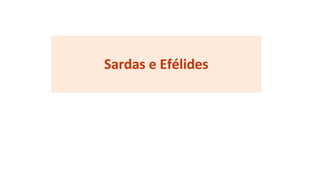 Sardas e Efélides
 