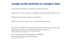 Lentigo senilis (actinica) ou Lentigem Solar
Presente em 90% dos caucasianos acima de 60 anos;
Presente em áreas expostas a radiação, principalmente mãos e rosto;
Diâmetro entre 1mm a alguns centímetros;
Geralmente são marrom claro, ocasionalmente escuros;
Diferem das efélides, pois estão diretamente relacionadas com a foto
exposição, enquanto as efélides aparecem na infância.
Fitzpatrick's Dermatology In General Medicine (Two Vol. Set) 6th edition (May 23, 2003)
PMID: 15140067http://www.ncbi.nlm.nih.gov/pubmed/15140067
São mais prevalentes comparadas às efélides;
Aumentam conforme envelhecemos;
http://www.ncbi.nlm.nih.gov/pubmed/10541041
 