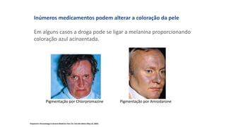 Inúmeros medicamentos podem alterar a coloração da pele
Em alguns casos a droga pode se ligar a melanina proporcionando
coloração azul acinzentada.
Pigmentação por Chlorpromazine Pigmentação por Amiodarone
Fitzpatrick's Dermatology In General Medicine (Two Vol. Set) 6th edition (May 23, 2003)
 