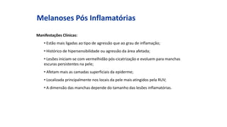 Manifestações Clínicas:
• Estão mais ligadas ao tipo de agressão que ao grau de inflamação;
• Histórico de hipersensibilidade ou agressão da área afetada;
• Lesões iniciam-se com vermelhidão pós-cicatrização e evoluem para manchas
escuras persistentes na pele;
• Afetam mais as camadas superficiais da epiderme;
• Localizada principalmente nos locais da pele mais atingidos pela RUV;
• A dimensão das manchas depende do tamanho das lesões inflamatórias.
Melanoses Pós Inflamatórias
 