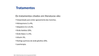 Os tratamentos citados em literaturas são:
• Fotoproteção para evitar agravamento das manchas;
• Hidroquinona 2 a 4%;
• Adapaleno 0,1 a 0,3%;
• Ácido Azeláico 20%;
• Ácido Kójico 1 a 4%;
• Arbutin 3%;
• Peelings químicos de ácido glicólico 20%;
• Laserterapia.
Tratamentos
PMID: 19706225http://www.ncbi.nlm.nih.gov/pubmed/19706225
 