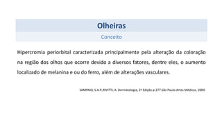 Olheiras
Conceito
Hipercromia periorbital caracterizada principalmente pela alteração da coloração
na região dos olhos que ocorre devido a diversos fatores, dentre eles, o aumento
localizado de melanina e ou do ferro, além de alterações vasculares.
SAMPAIO, S.A.P.;RIVITTI, A. Dermatologia, 2ª Edição.p.277.São Paulo:Artes Médicas, 2000.
 