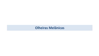 Olheiras Melânicas
 