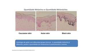 Quantidade Melanina vs Quantidade Melanócitos
Histologia de peles com diferentes grupos étnicos. A quantidade melanina é
diferente, porém a quantidade de melanócitos é praticamente a mesma.
http://www.ncbi.nlm.nih.gov/pmc/articles/PMC2671032/#!po=46.5517
 