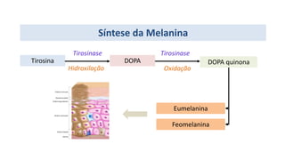 Tirosina DOPA
Tirosinase
Hidroxilação
DOPA quinona
Tirosinase
Oxidação
Eumelanina
Feomelanina
Síntese da Melanina
 