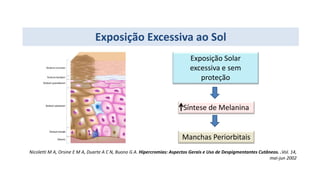 Exposição Excessiva ao Sol
Nicoletti M A, Orsine E M A, Duarte A C N, Buono G A. Hipercromias: Aspectos Gerais e Uso de Despigmentantes Cutâneos. .Vol. 14,
mai-jun 2002
Exposição Solar
excessiva e sem
proteção
Síntese de Melanina
Manchas Periorbitais
 