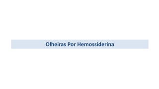 Olheiras Por Hemossiderina
 