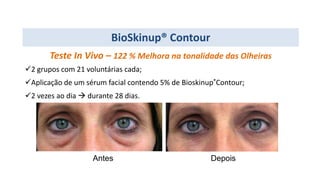Teste In Vivo – 122 % Melhora na tonalidade das Olheiras
2 grupos com 21 voluntárias cada;
Aplicação de um sérum facial contendo 5% de Bioskinup®Contour;
2 vezes ao dia  durante 28 dias.
Antes Depois
BioSkinup® Contour
 
