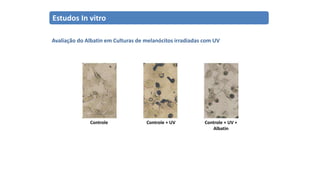 Estudos In vitro
Avaliação do Albatin em Culturas de melanócitos irradiadas com UV
Controle Controle + UV Controle + UV +
Albatin
 